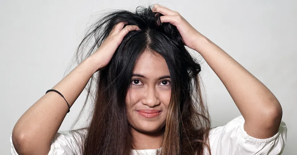 Jangan Risih Lagi Ini 8 Penyebab Kulit Kepala Genpi Co Jogja